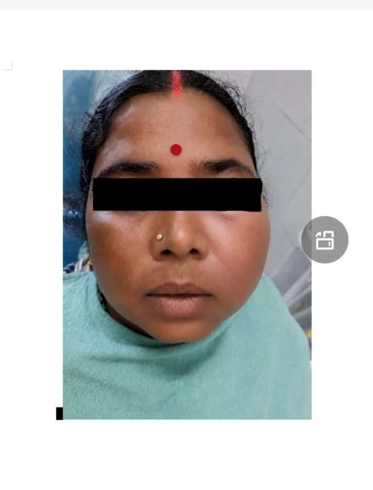1012786281